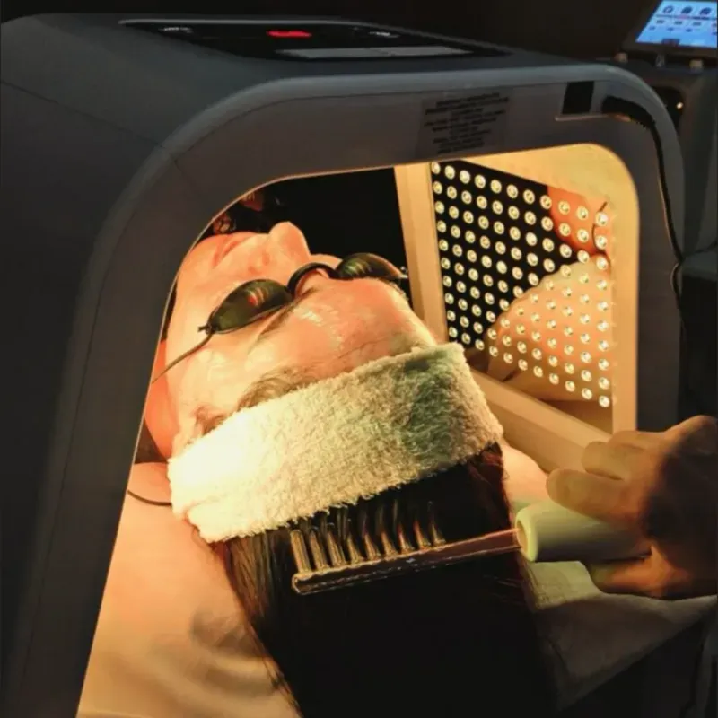 Alta frecuencia capilar+Biofotomodulación