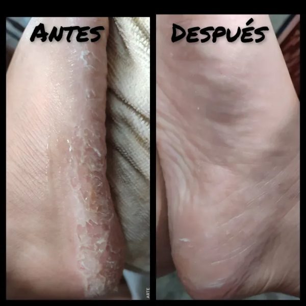 Pedicura spa