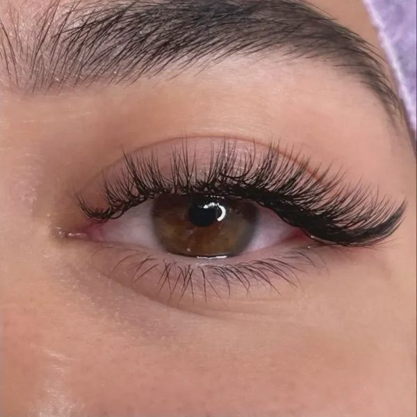 Efecto ojo de gato