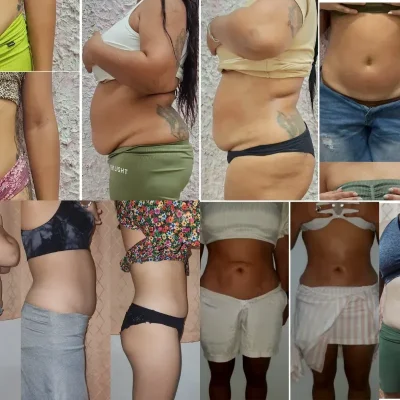 Paquete 3 en 1,  10 sesiones
