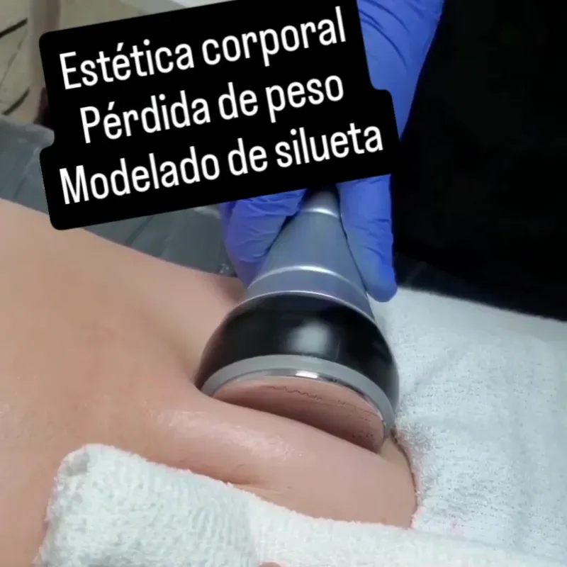 Ultracavitación + Lipoláser