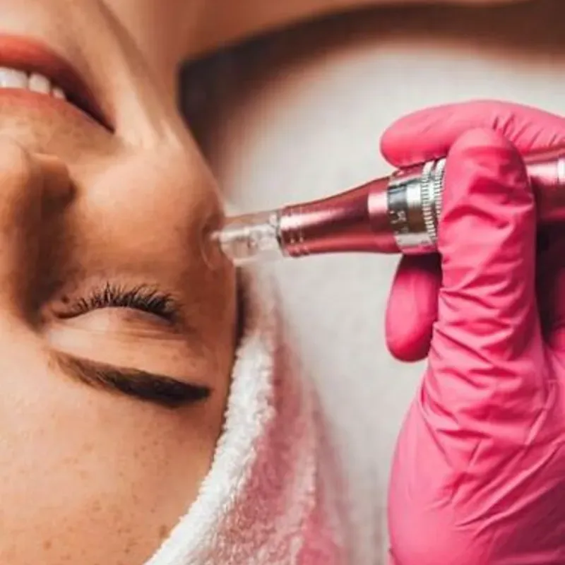 Hidratación facial con dermapen