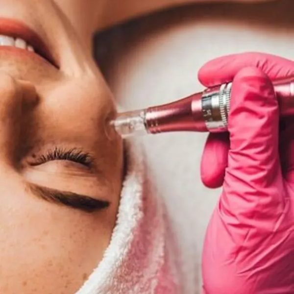 Hidratación facial con dermapen