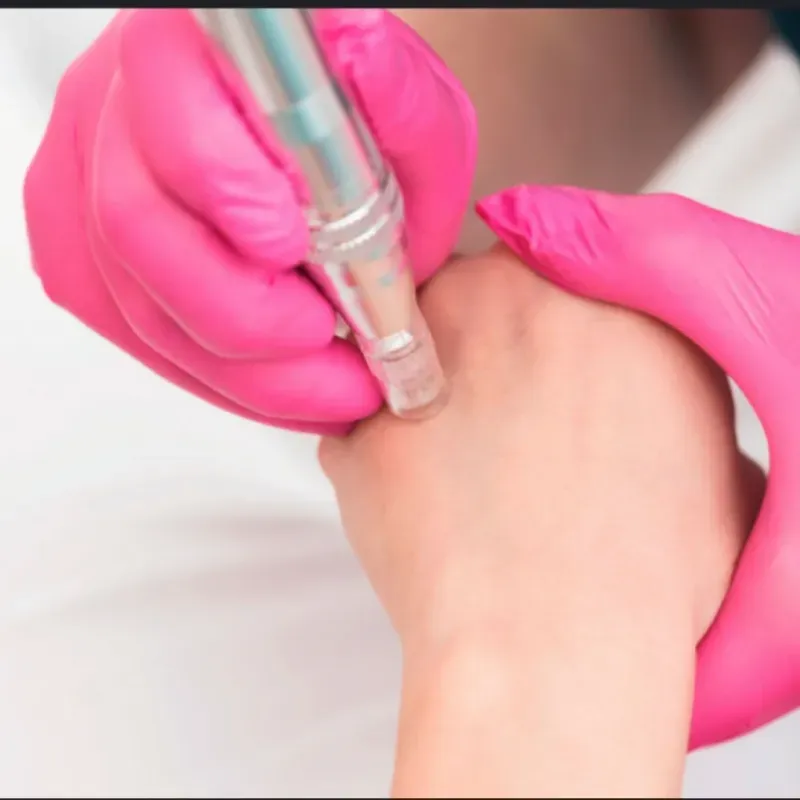 Rejuvenecimiento de manos o Hidratación