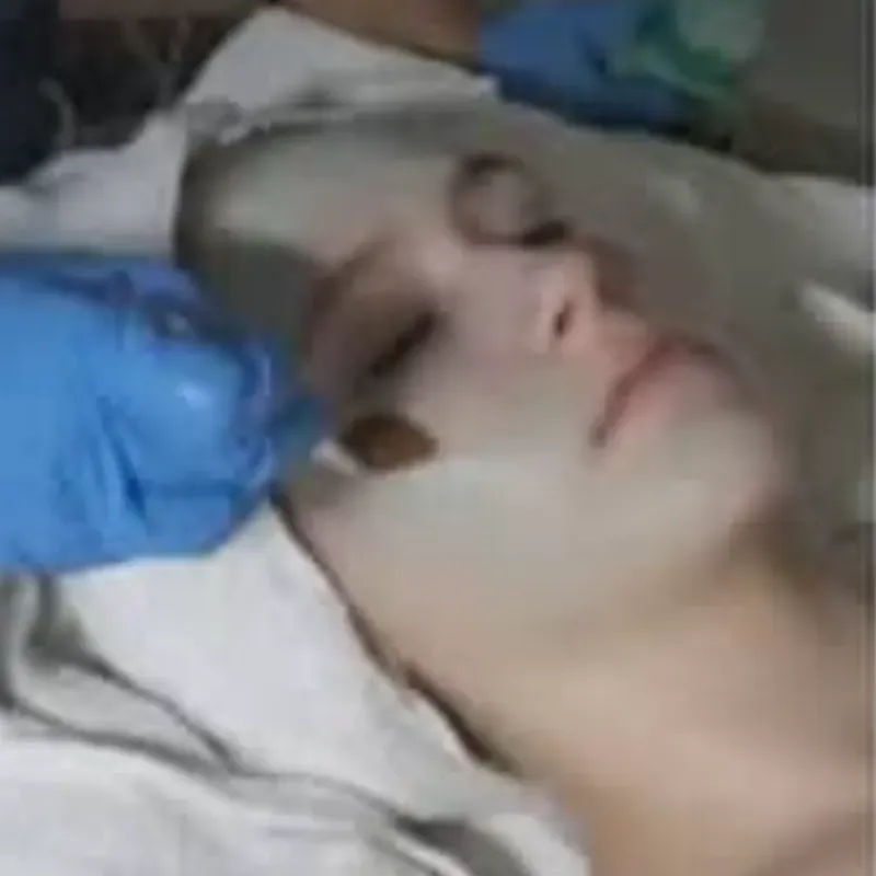 Masaje Facial (0:50 minutos)