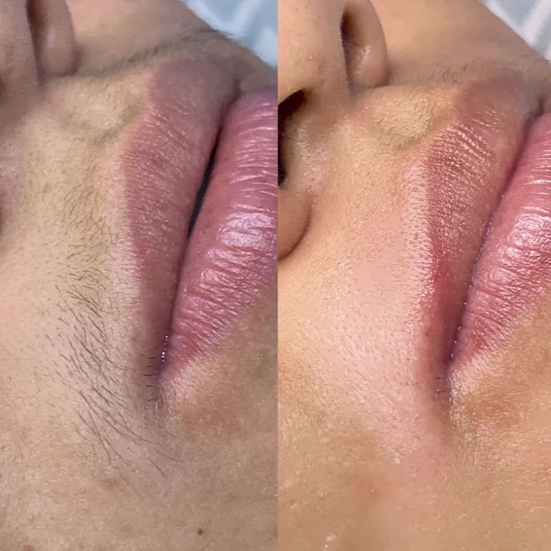 Depilación con Cera