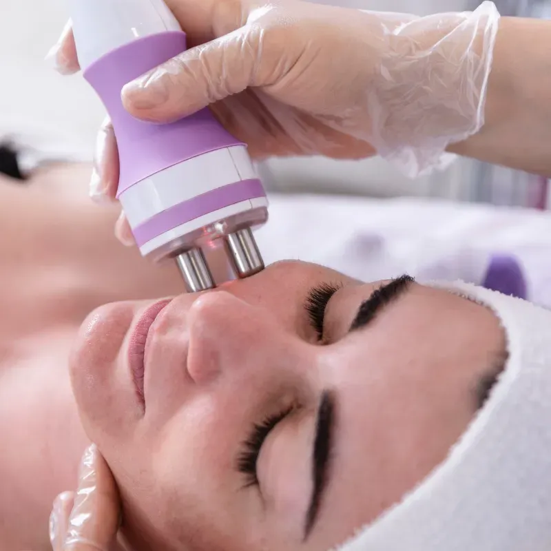 Radiofrecuencia facial.