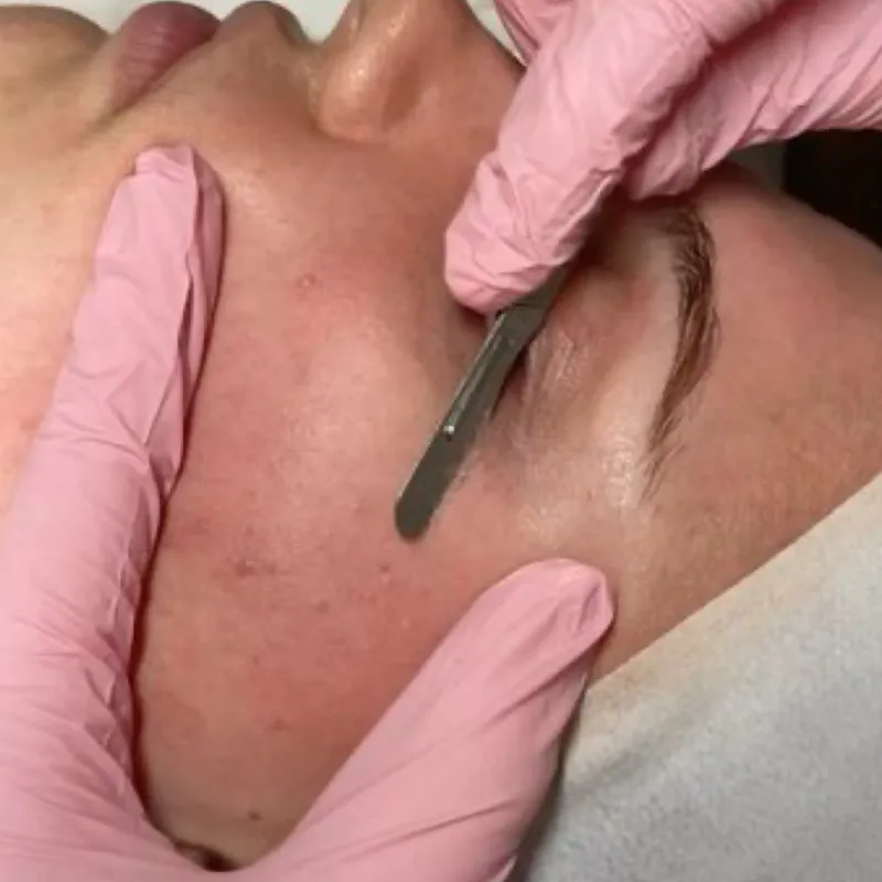3000 pesos  Dermaplaning + Limpieza Facial