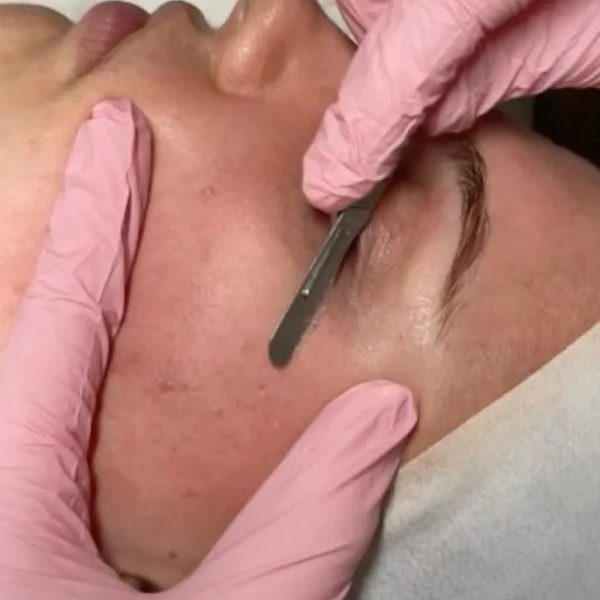 3000 pesos  Dermaplaning + Limpieza Facial
