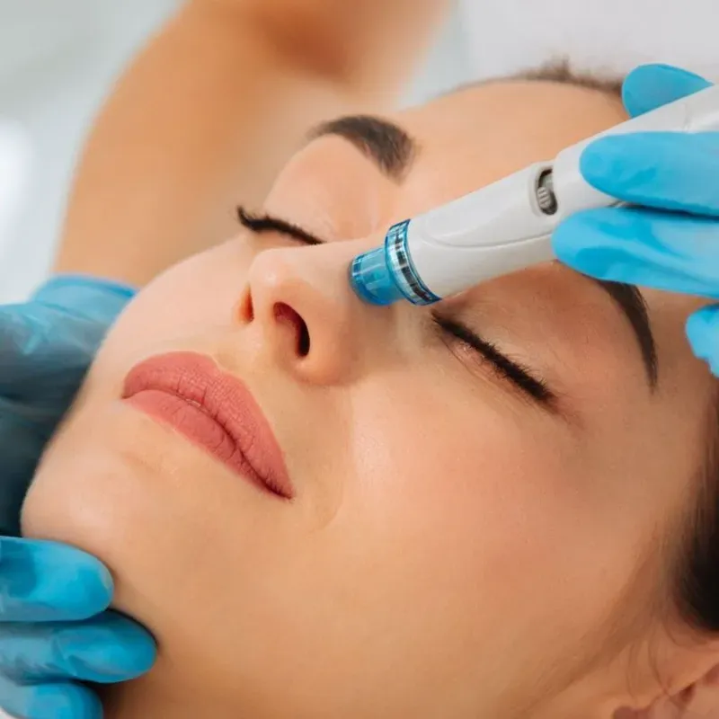 Hydrafacial
