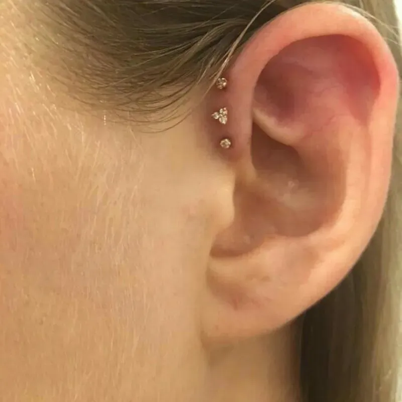 Forward Helix