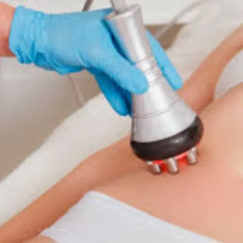 Radio frecuencia Corporal