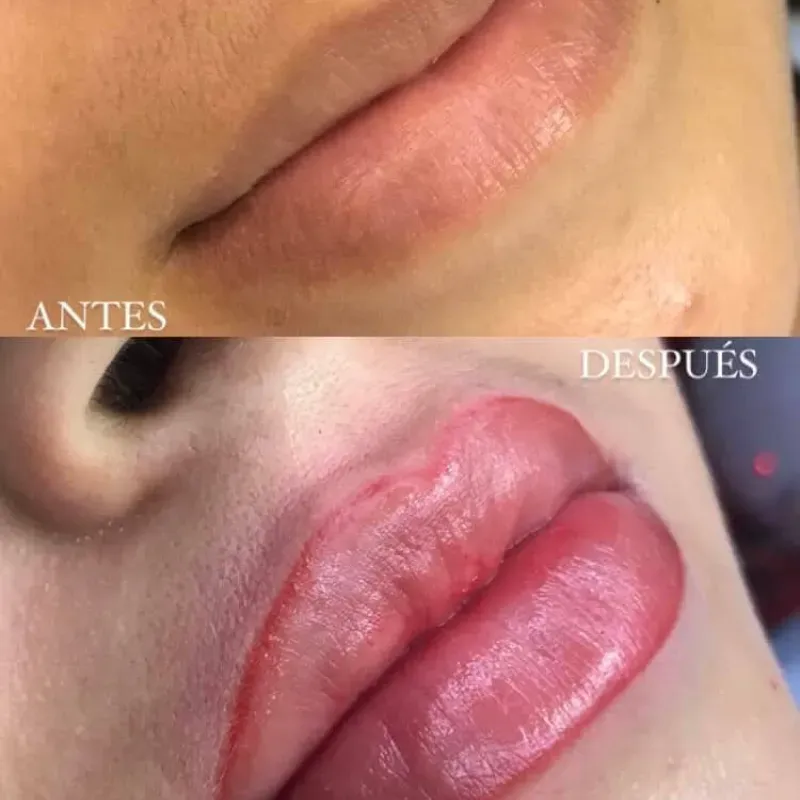 Contorno de labios