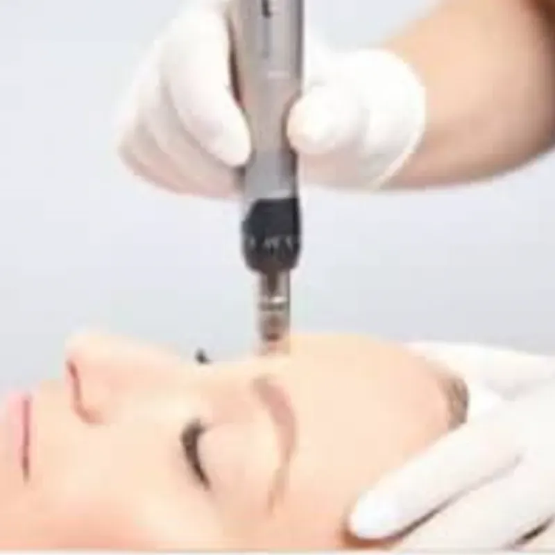 Micropunción con dermapen