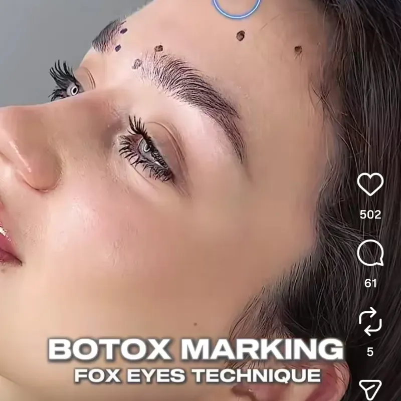 Servicio de Baby Botox facial