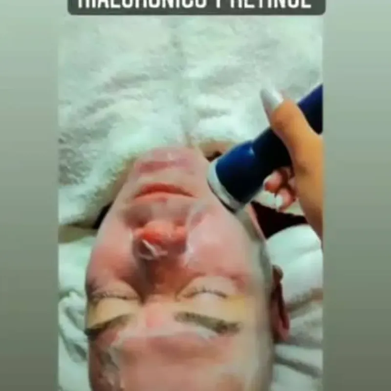 Fonoforesis (ultrasonido + nutrición)