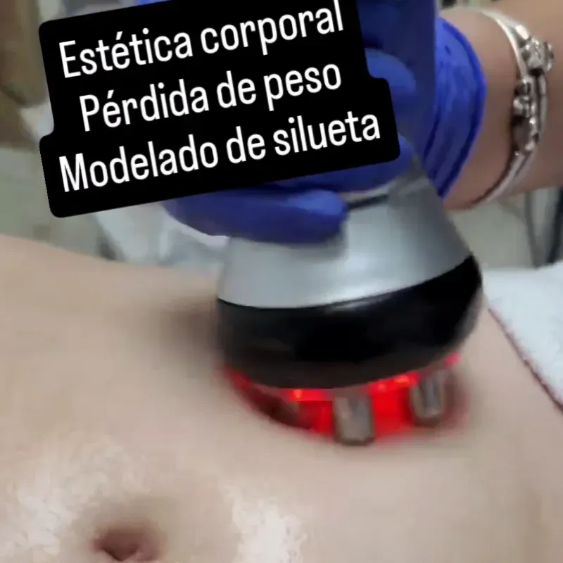 Ultracavitación + Lipoláser+ Radiofrecuencia