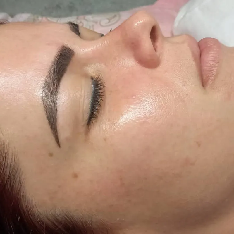 Tratamiento Hidratante