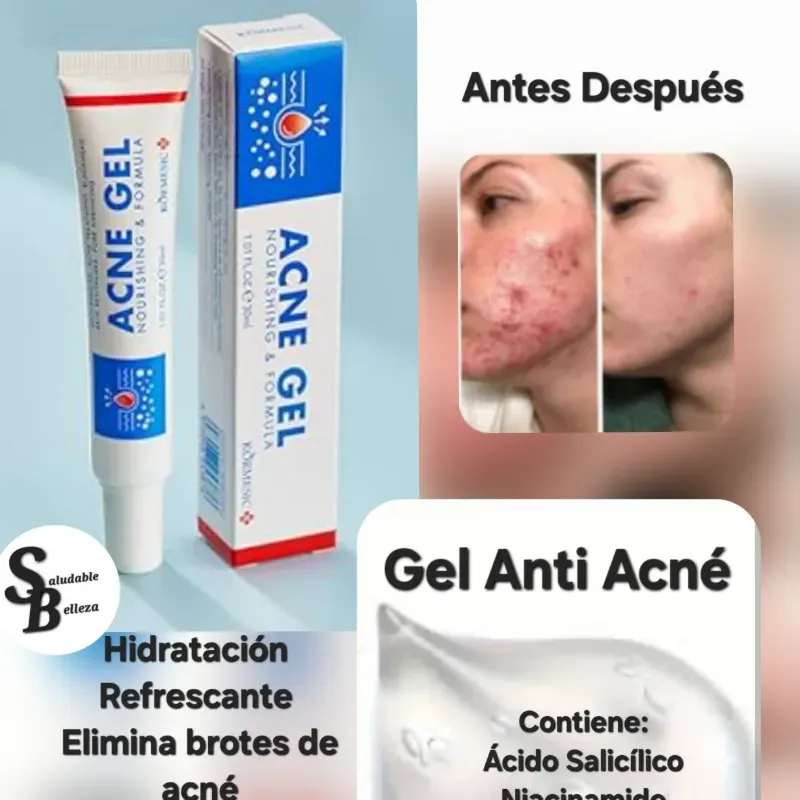 Gel Anti acné