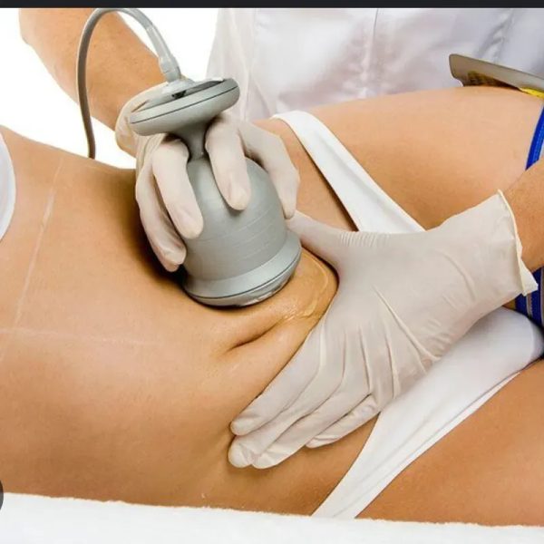 Ultracavitacion