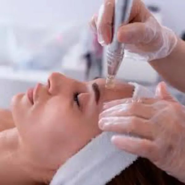Microneedling Facial
