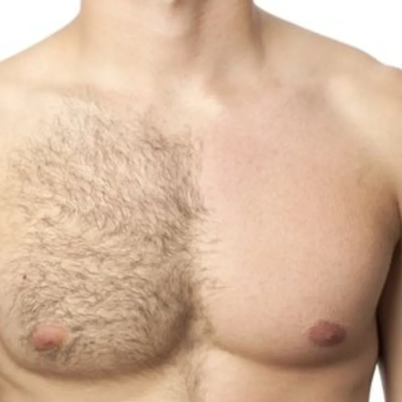 Depilación de Pecho, Espalda o Abdomen