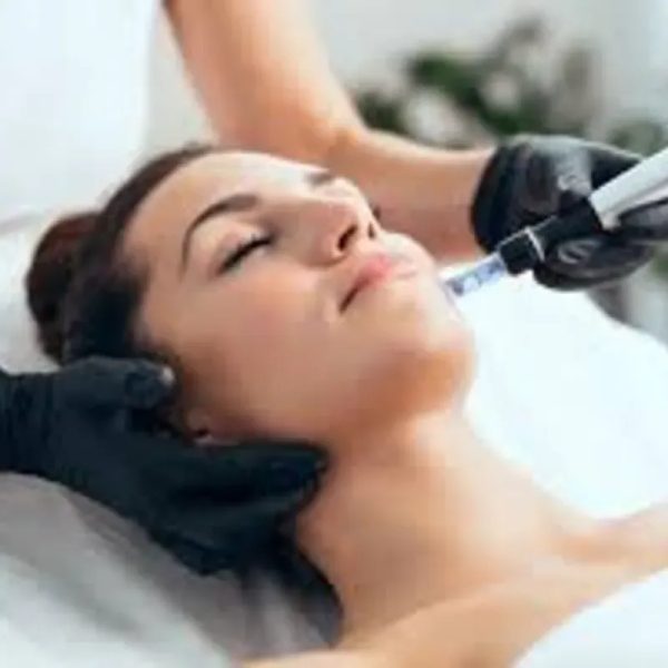 Taller DERMAPEN -MICRONEEDLING