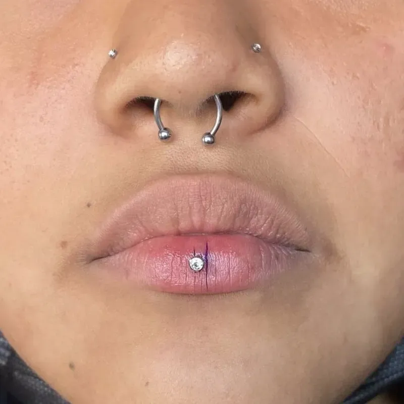 Pack Estético (4–5 perforaciones)