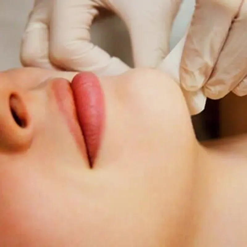 ️ Depilación de Barbilla