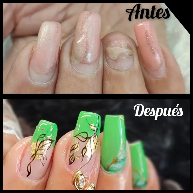 Reposición de 1 uña mediana