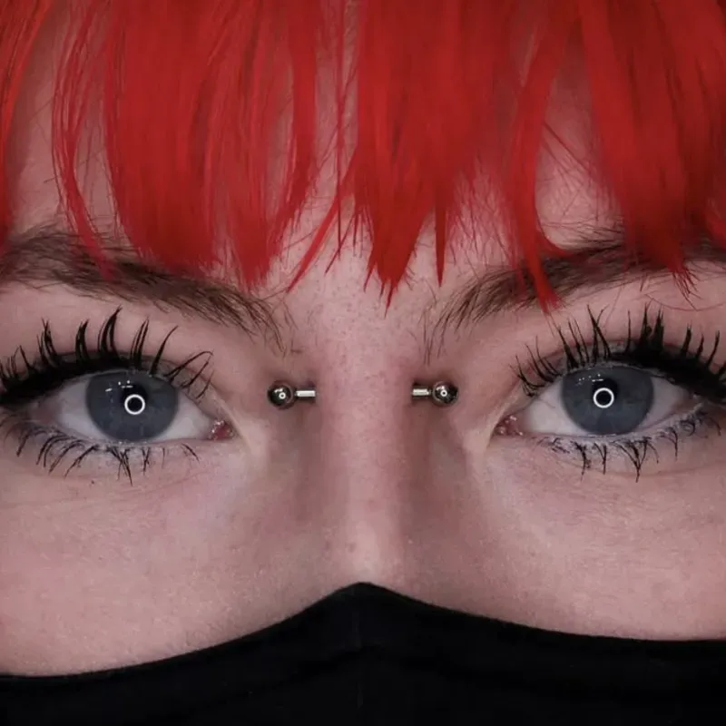 Bridge (nasallang superficial)