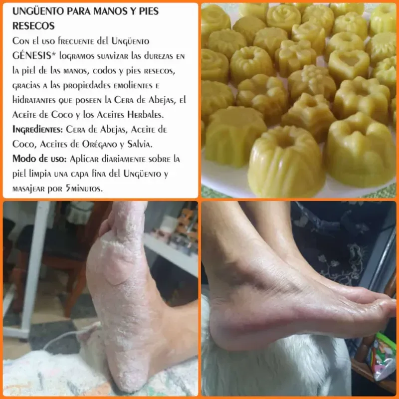 Cera hidratante para manos y pies resecas