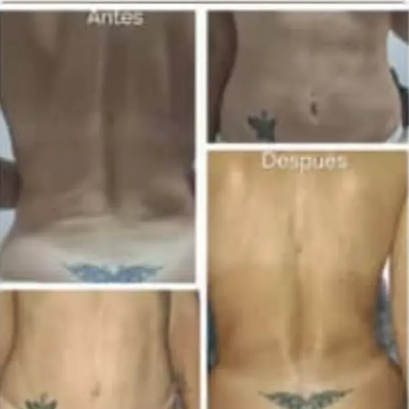 Masaje Post Operatorio ( Cuerpo entero)