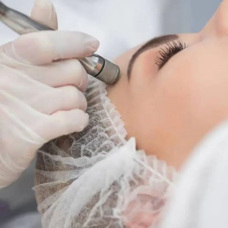 MICRODERMOABRASIÓN CON PUNTA DE DIAMANTES