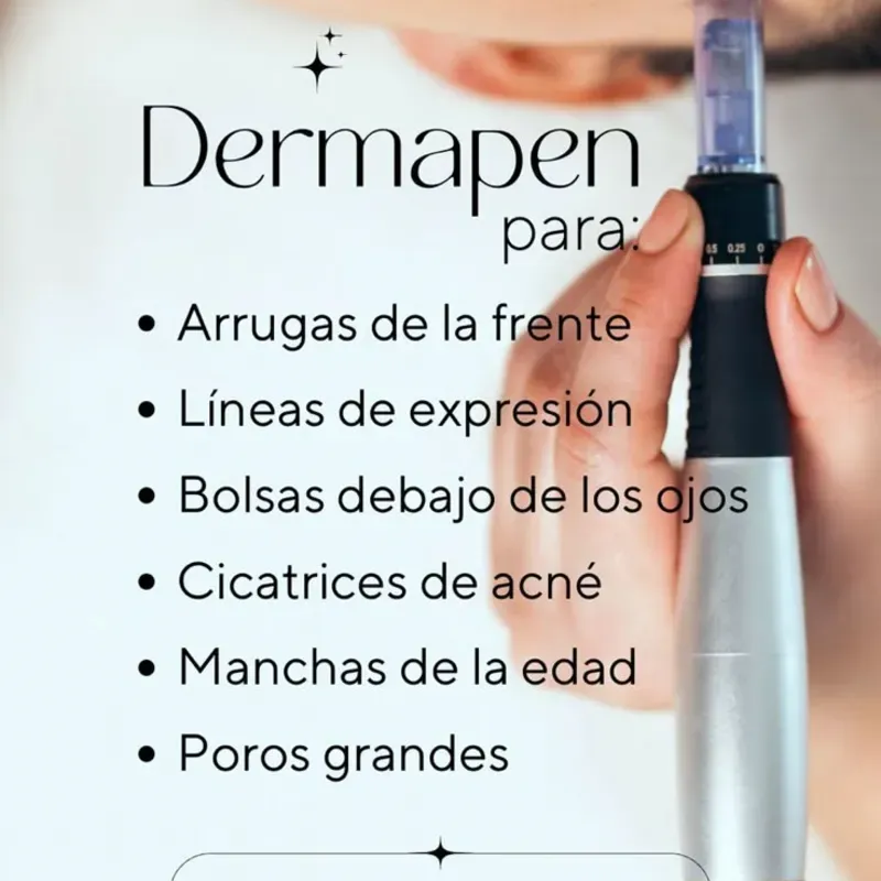 Microneedling