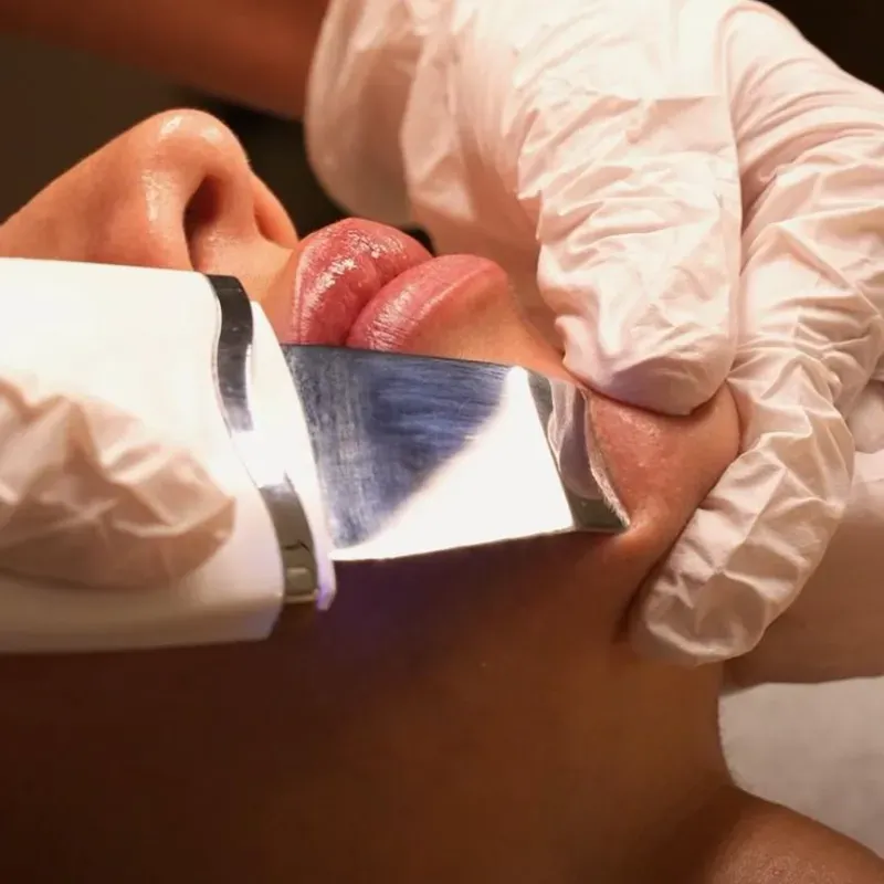 HIGIENE FACIAL PROFUNDA