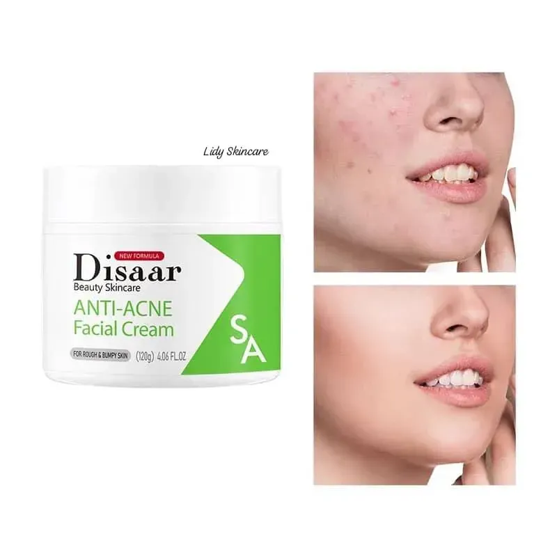 Crema anti acne con acido salicilico