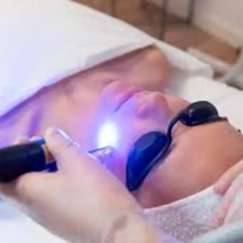 Taller LÁSER picosecond azul: Neatcell