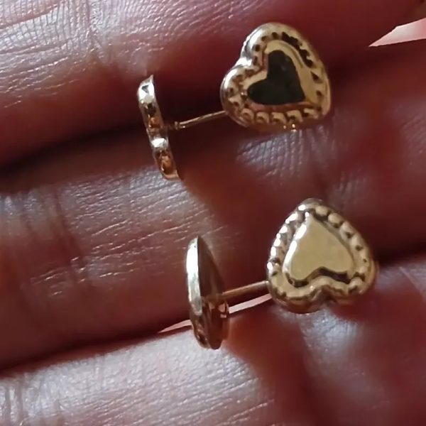 Aretes