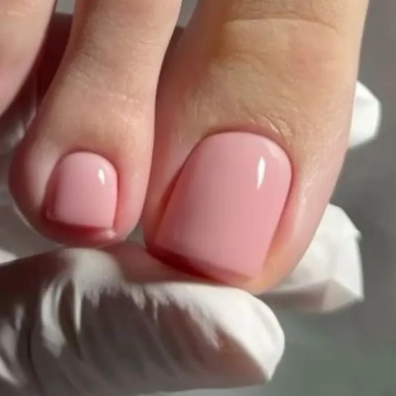 Reconstrucción de uña