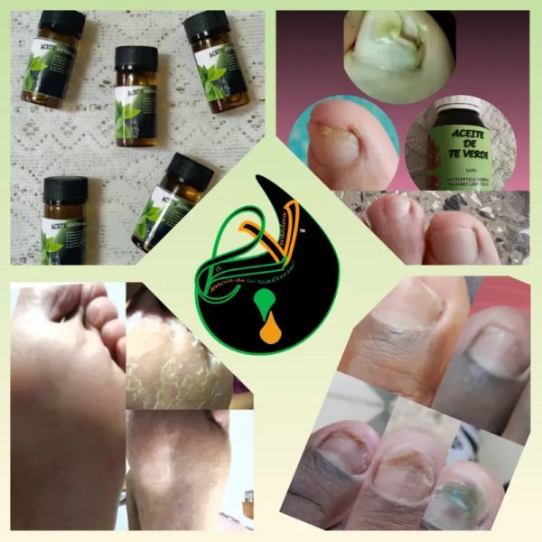 Aceites % naturales