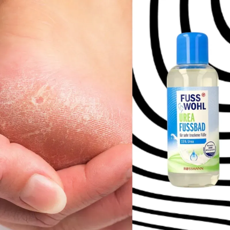 BAÑO DE PIES  15% UREA Y GLICERINA