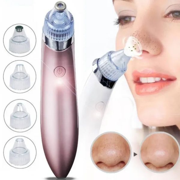 Extractor de Puntos Negros