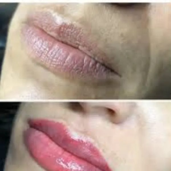 Hidralips o BB lips