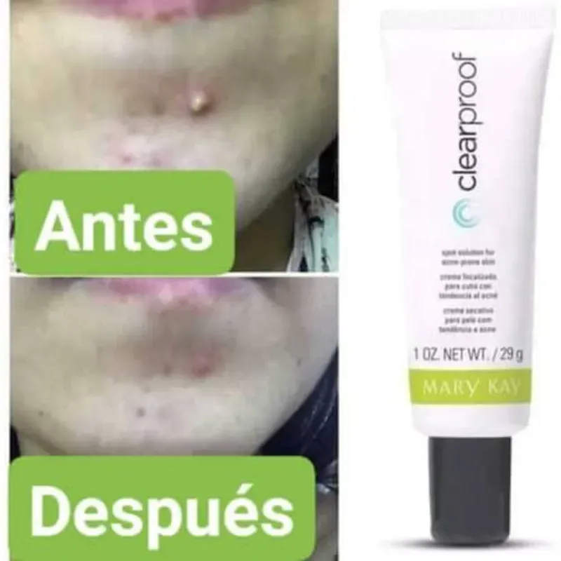 Crema focalizada Clear proof Mary Kay