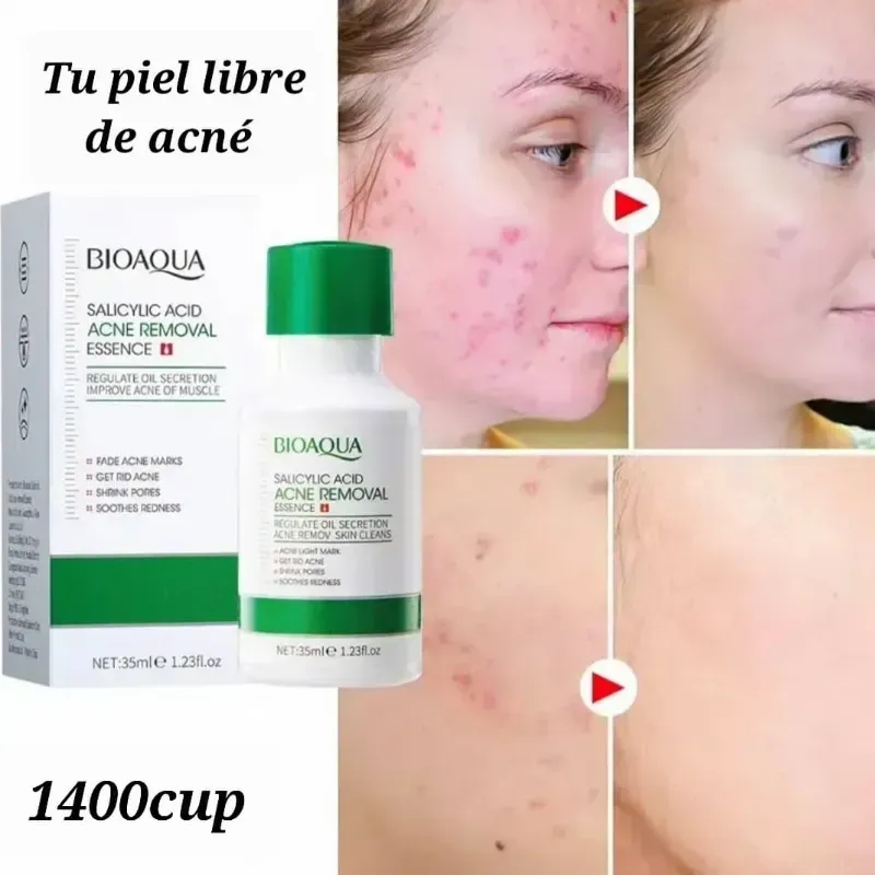 Serum Facial de Ácido Salicílico