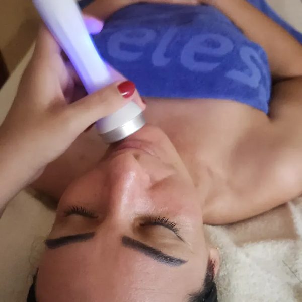 Ultrasonido facial