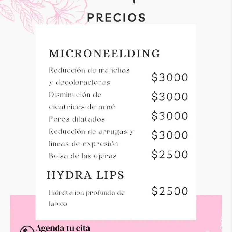 Microneelding -Hidra Lips
