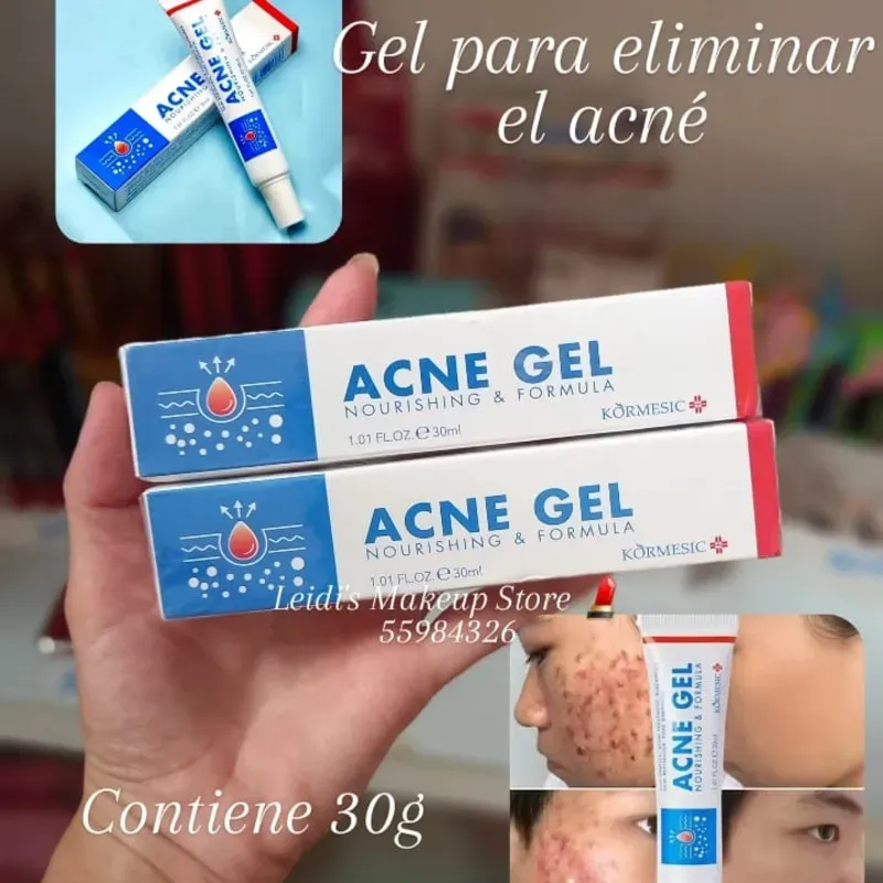 Gel para eliminar el acné