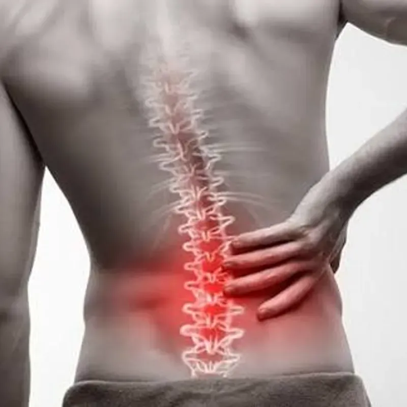 FISIOTERAPIA DE COLUMNA LUMBAR Y SACRA